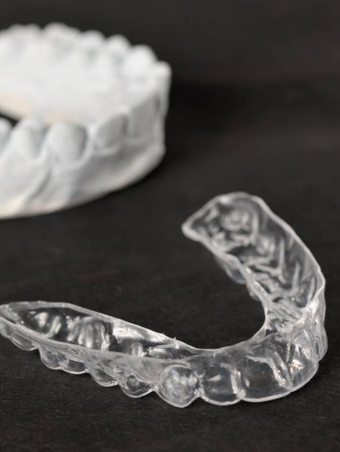 Clear nightguard for bruxism in Cary