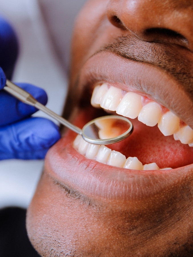 Close up of man with dental mirror in his mouth while visiting cosmetic dentist in Cary