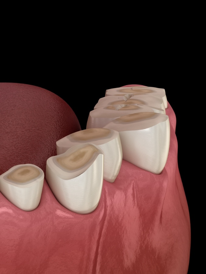 Close up of animated row of worn down teeth