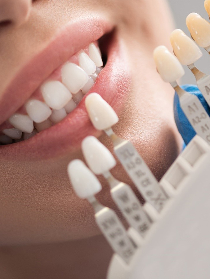 Man smiling with dental crowns and bridges in Cary