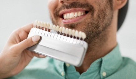 Man with tooth color chart getting veneers