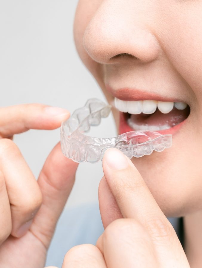 Close up of person putting Invisalign tray in their mouth