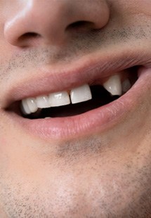 man smiling with gap in the smile 