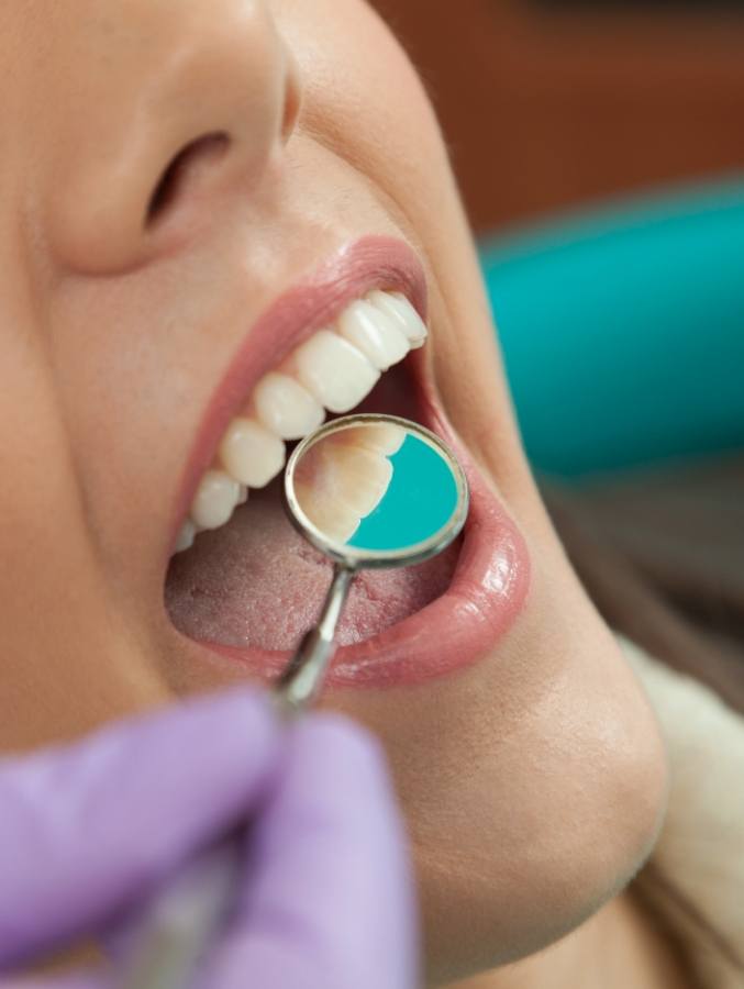 CLose up of dental mirror in mouth during preventive dentistry visit