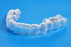 Invisalign aligner