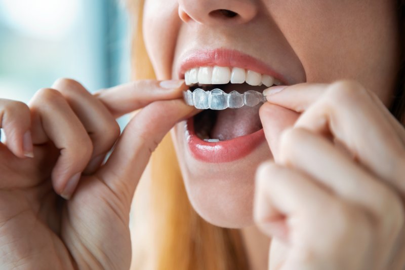 Patient putting in new Invisalign trays