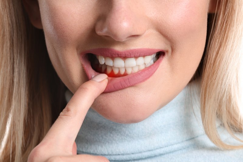 A patient with gum disease