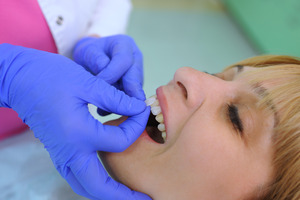 Woman having a veneer placed on front tooth