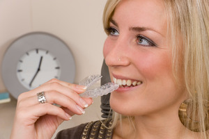 Blonde woman putting in an Invisalign aligner