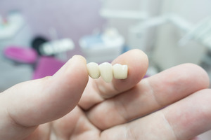 Close-up of gloved hand holding a dental bridge