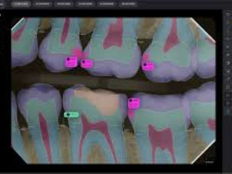 close up of digital x-ray | cary dentist