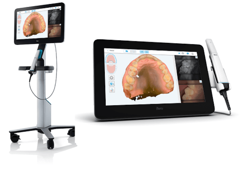 close up of digital impressions | dental crowns cary 
